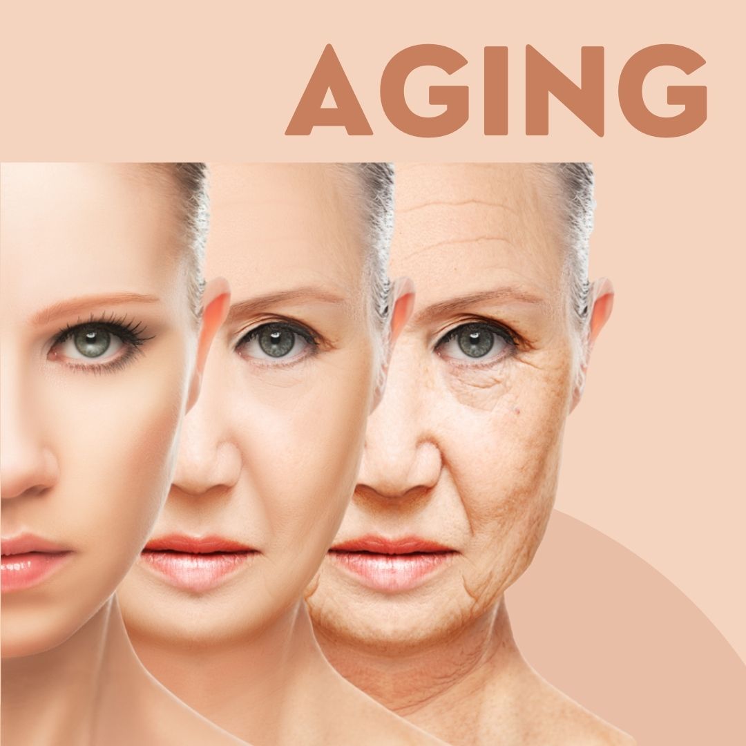 Aging