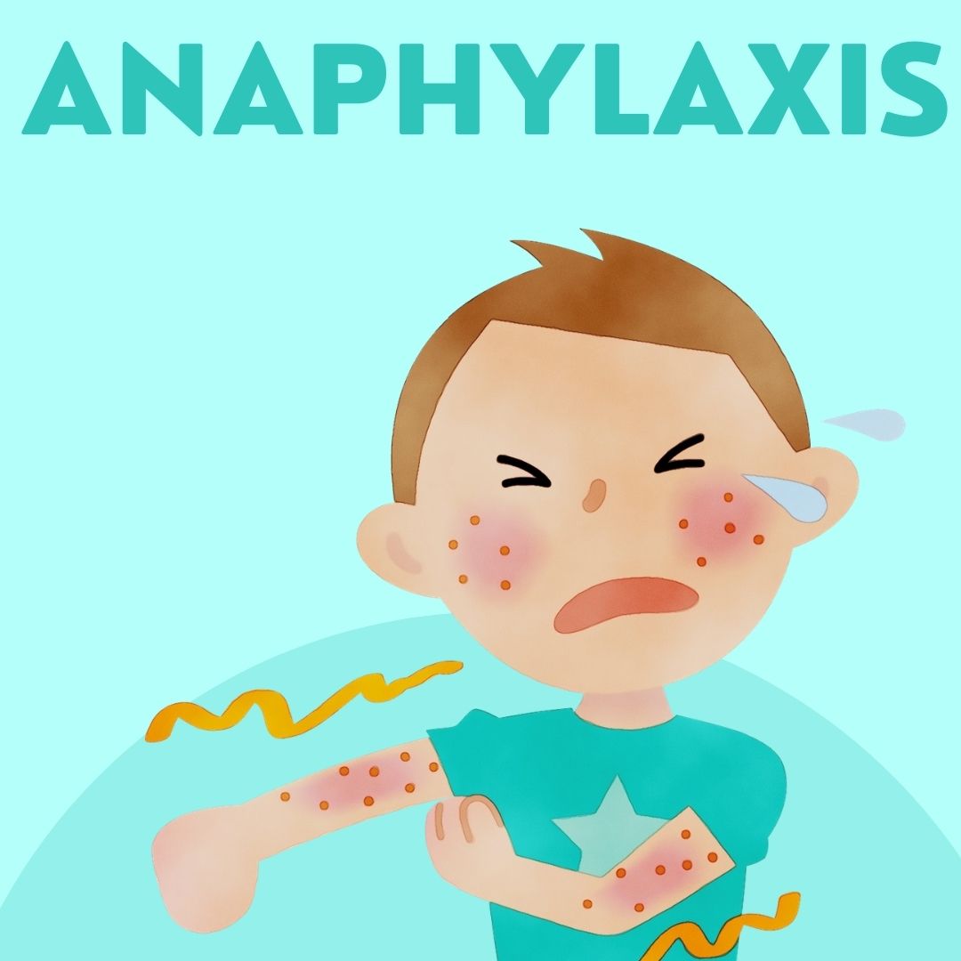 Anaphylaxis