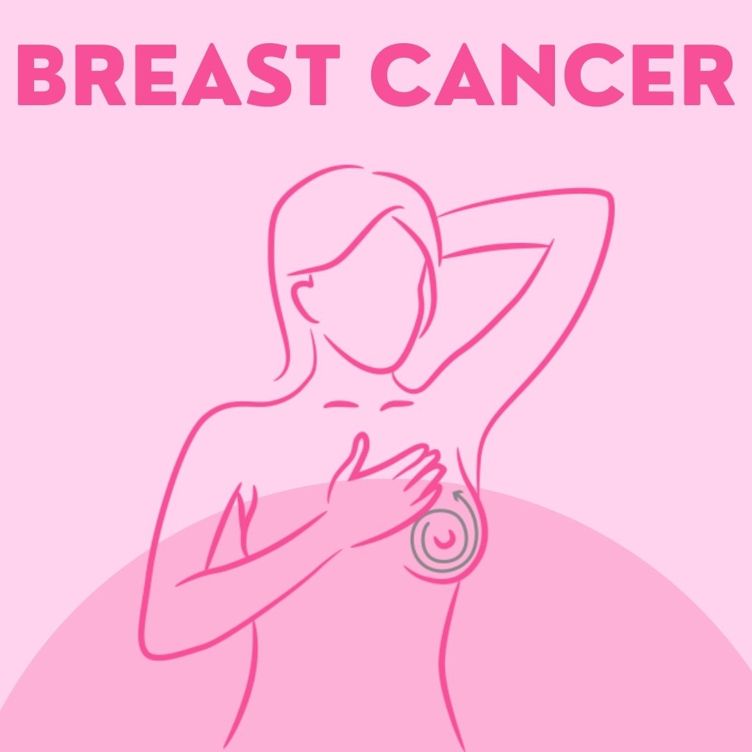 Breast Cancer