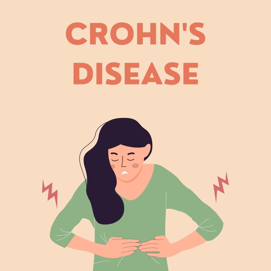Crohn's Disease