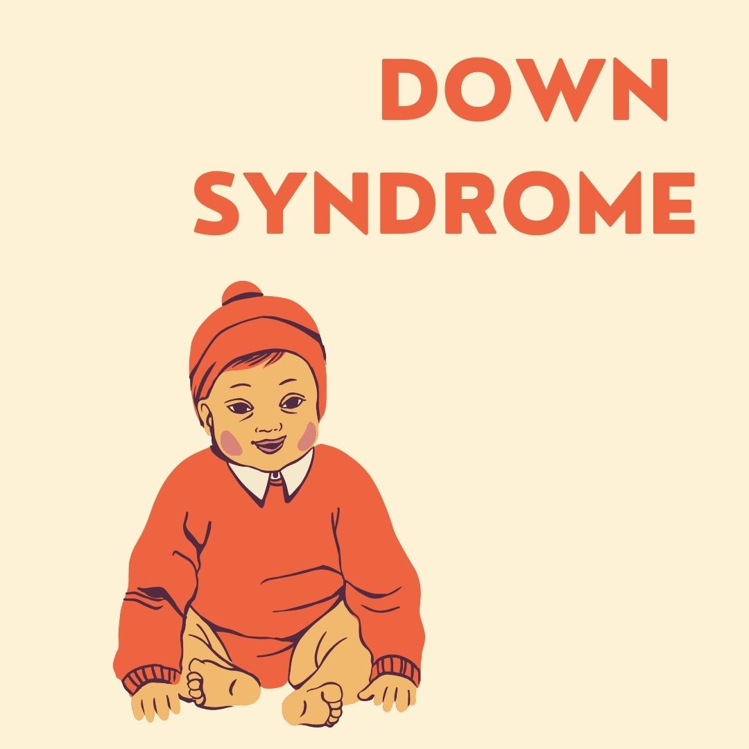 Down Syndrome