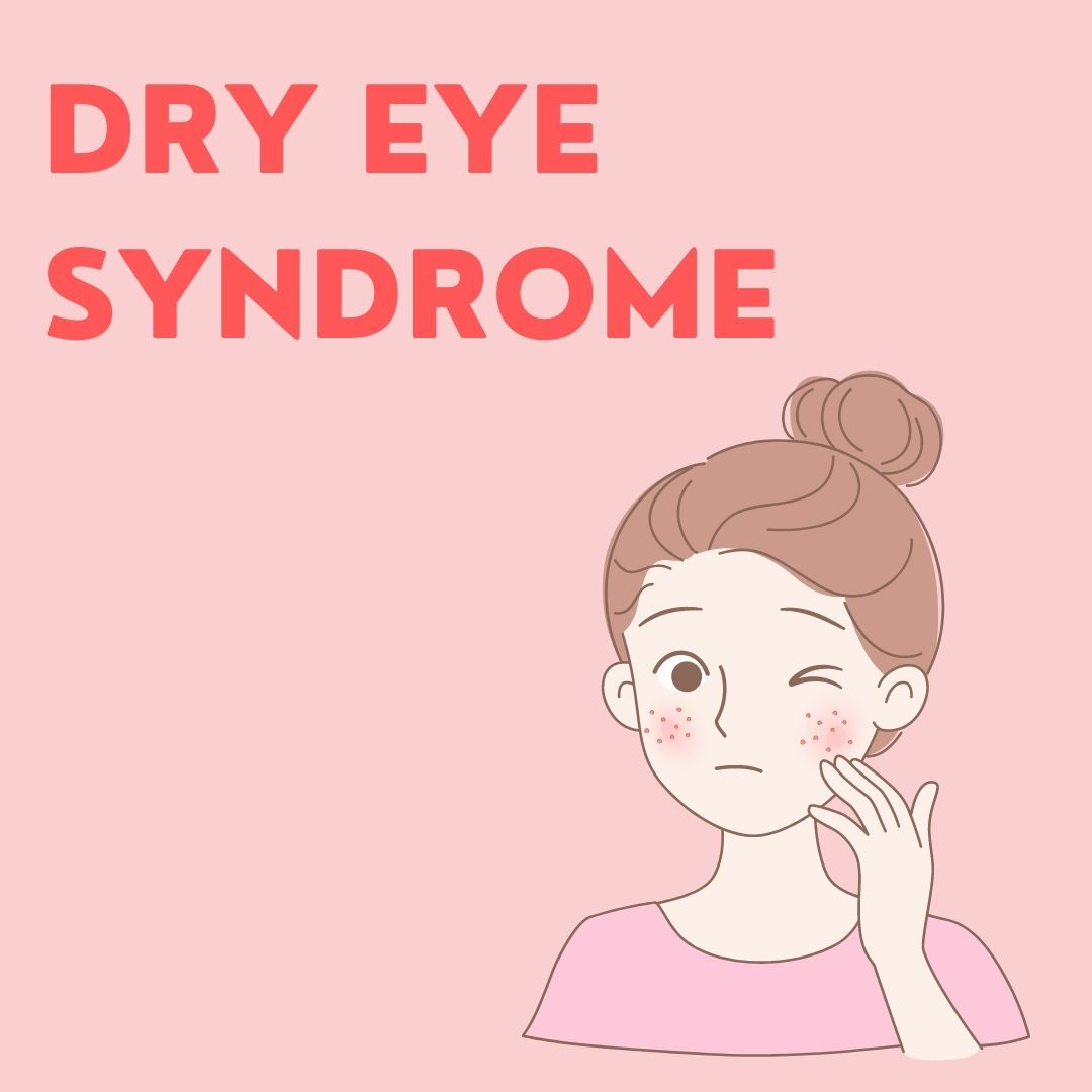 Dry Eye Syndrome