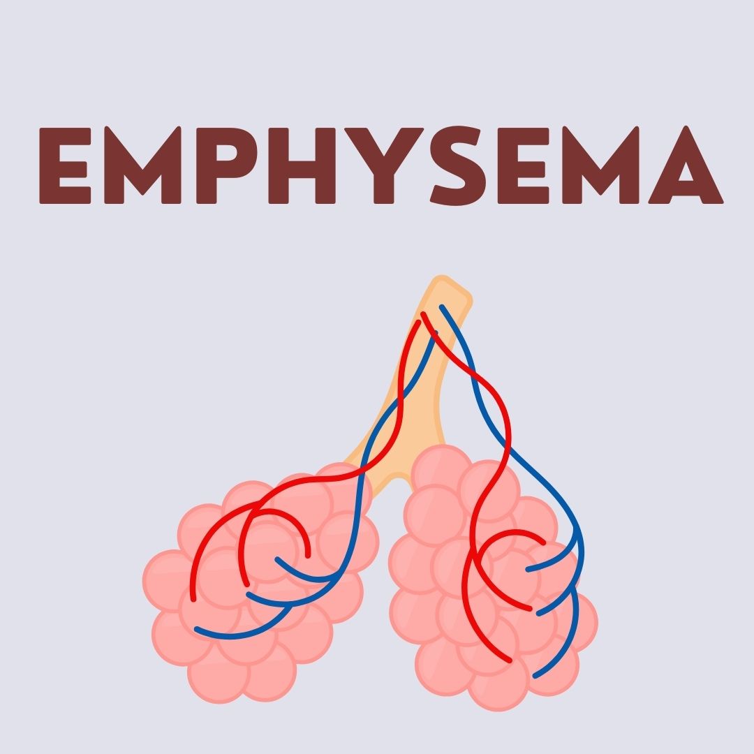 Emphysema