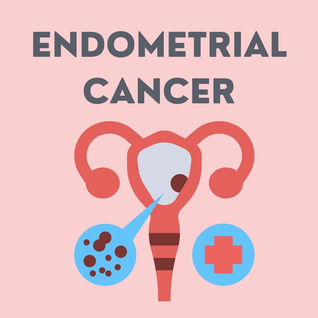 Endometrial Cancer
