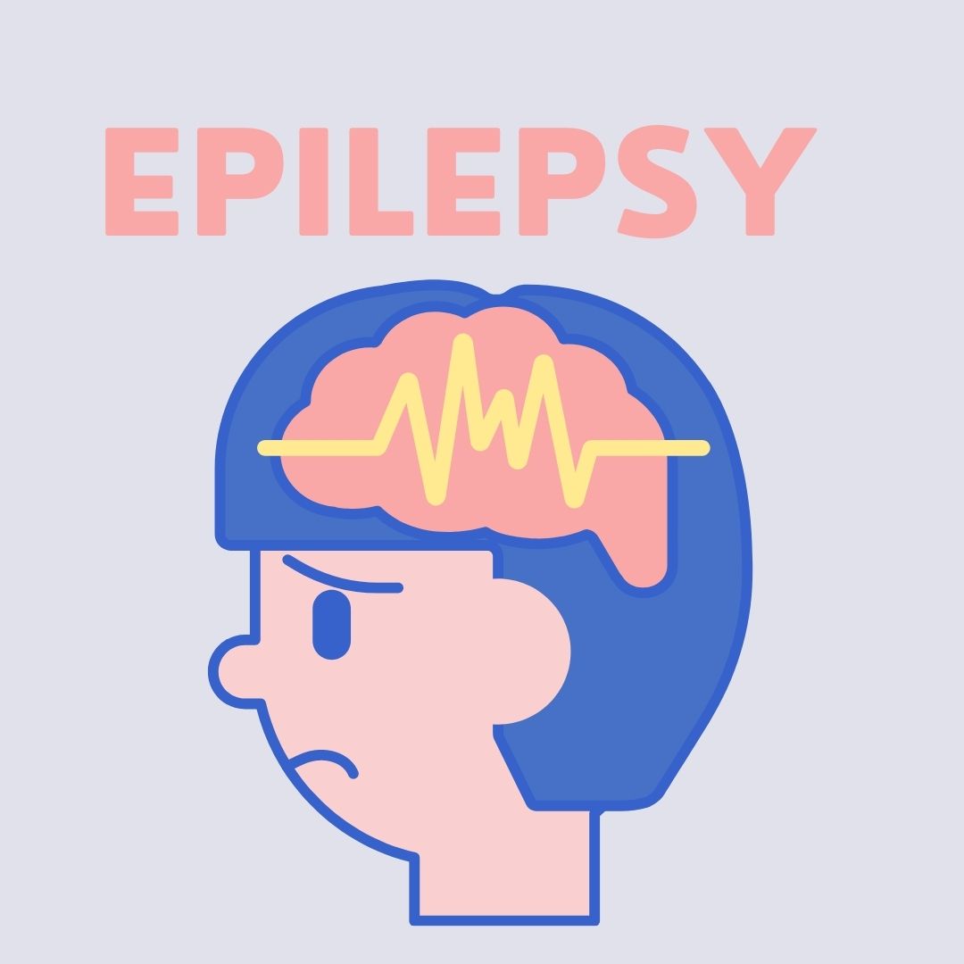 Epilepsy