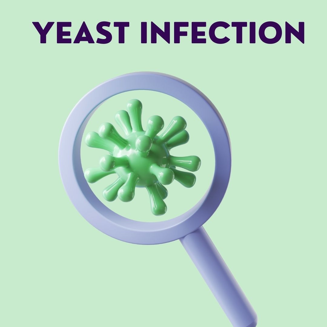 Yeast Infection