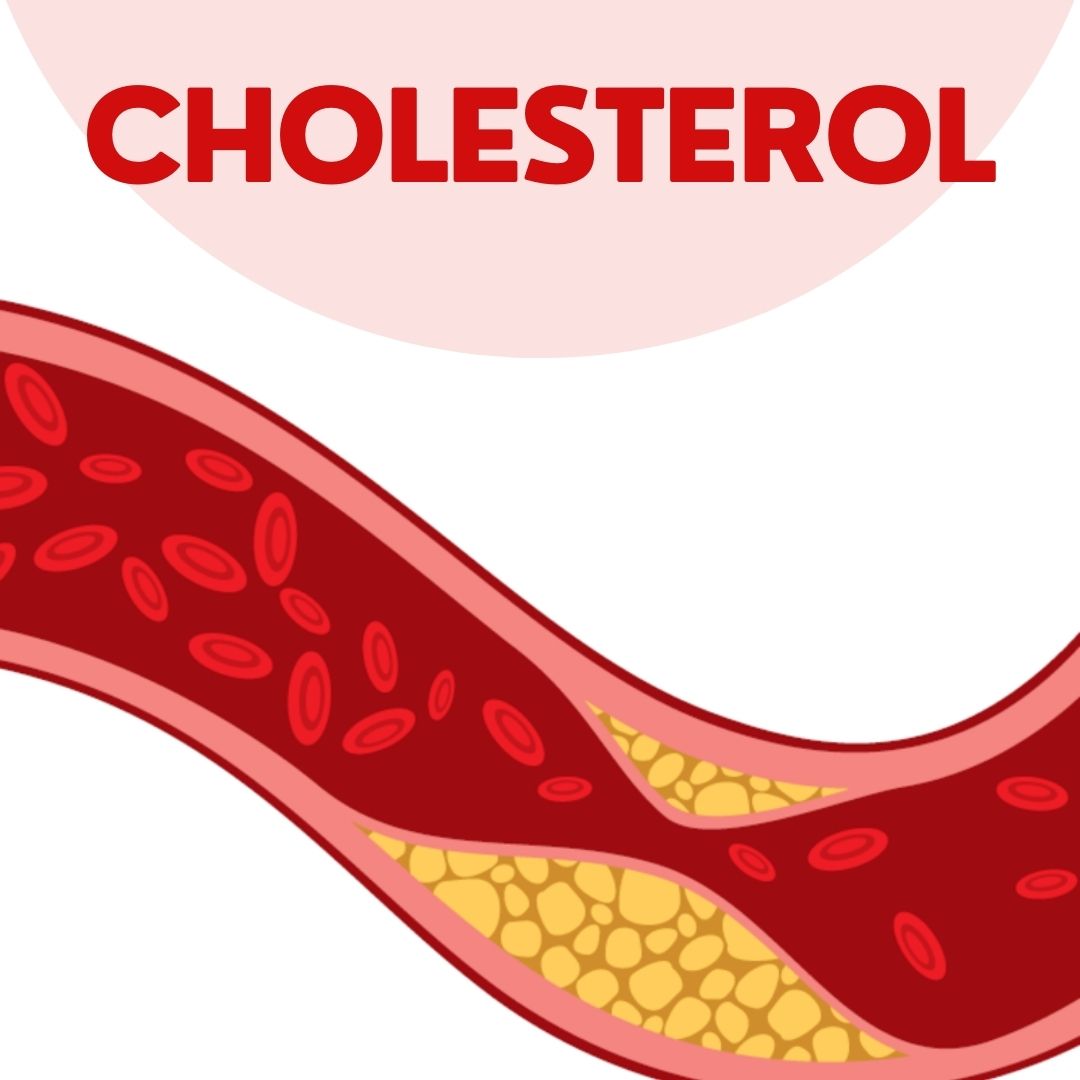 Cholesterol