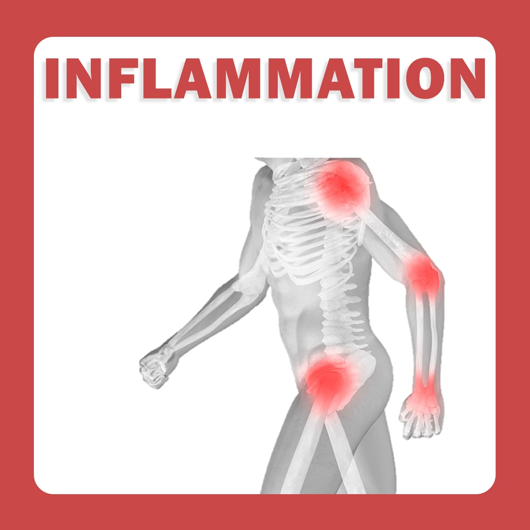 Inflammation