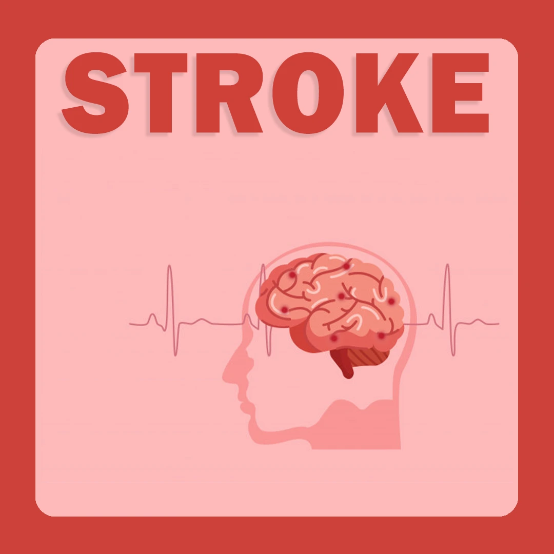 Stroke