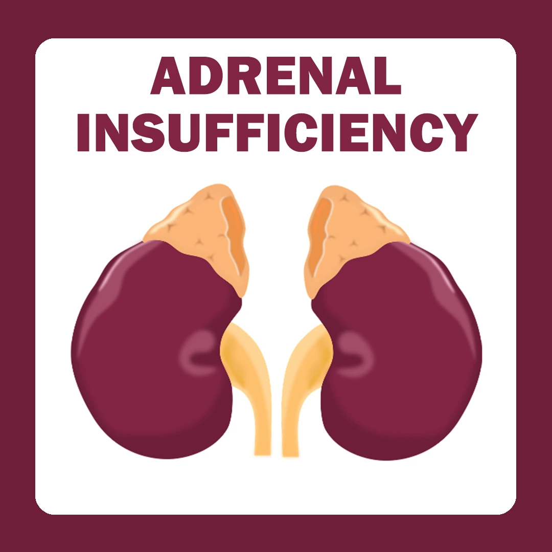 Adrenal Insufficiency