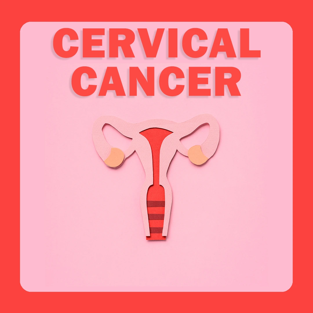 Cervical Cancer
